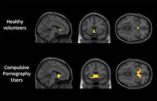 Trop de porno réduit la matière grise du cerveau