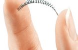 Essure, c’est pas sûr…