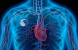 Pacemakers : les dangers de l’interface