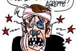 Ignace - L'affaire Benalla fait mal à Macron